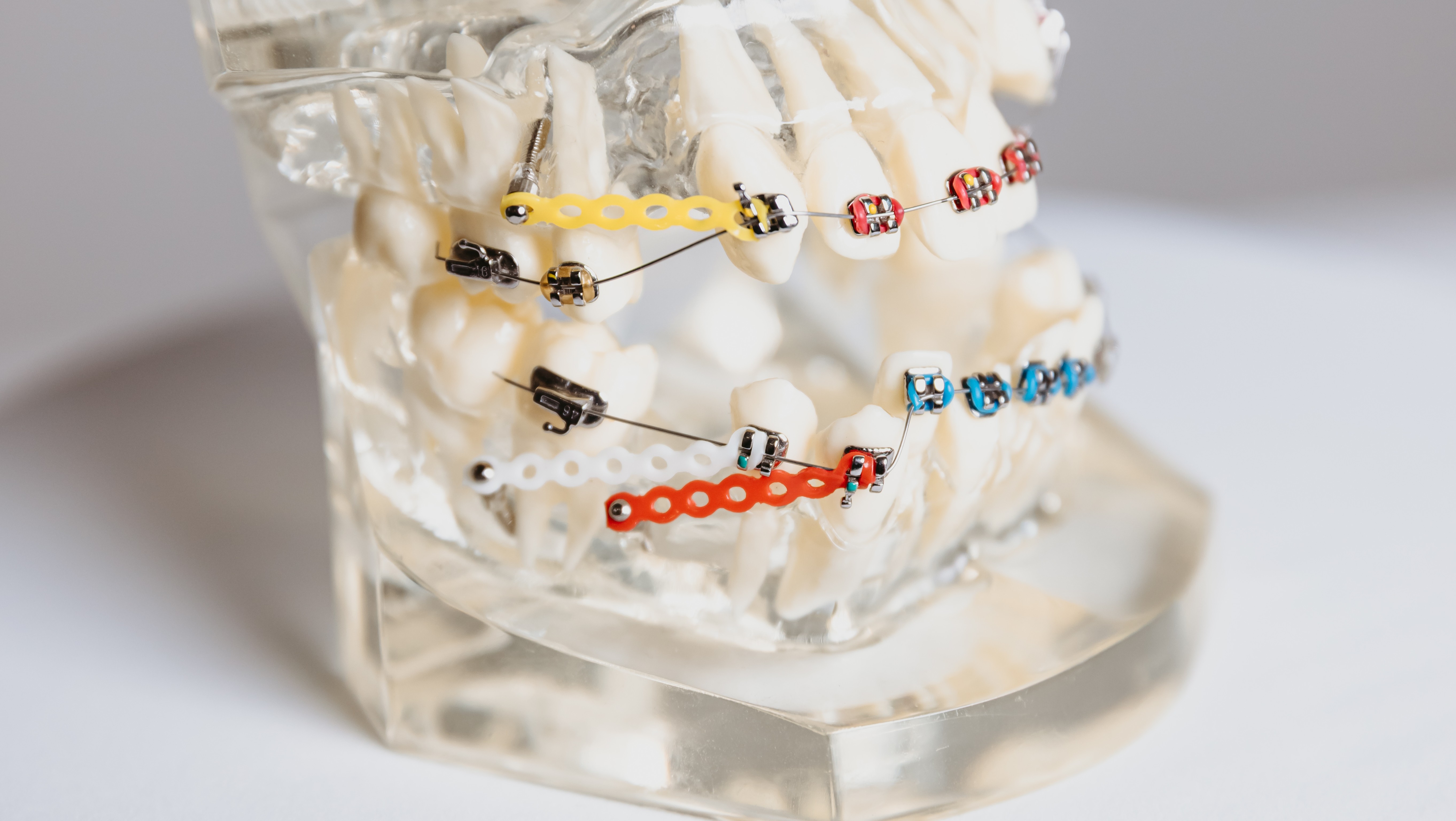 Advanced Orthodontics